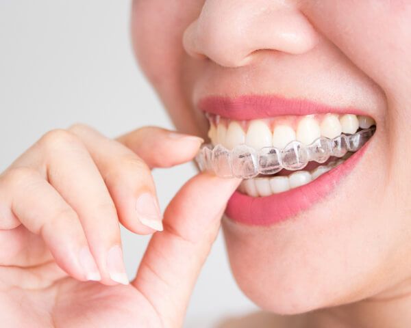 orthodontics Thousand Oaks CA