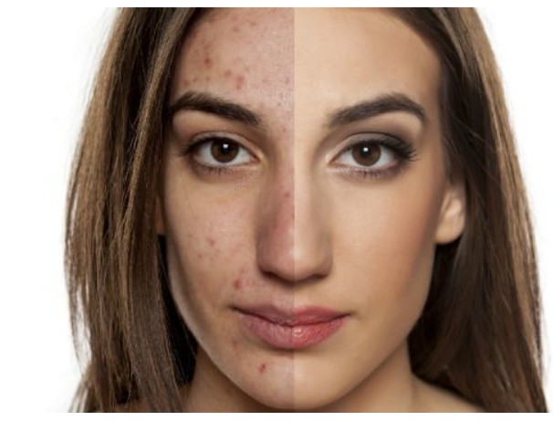 wrinkles treatment mission viejo ca